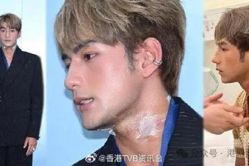 魏浚笙受伤后首现身 重提意外犹有余悸 被绳索缠颈有窒息感觉