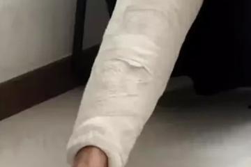 狮城女新山受伤 求助无人理 还是新加坡最好!